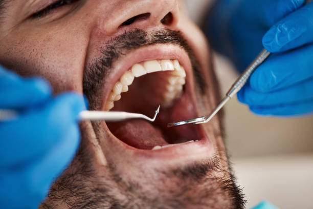 Best Emergency Broken Tooth Repair in Tunica, MS