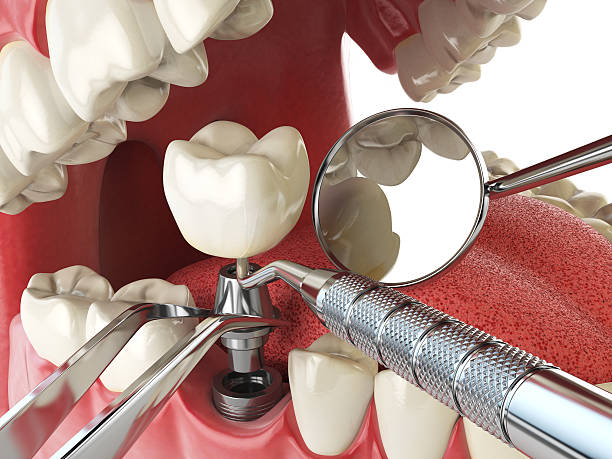 Best Pediatric Emergency Dentist in Tunica, MS